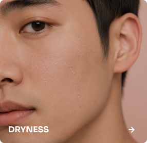 Dryness